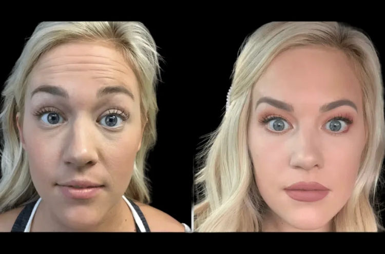 Top-Rated Botox Clinics with Best Doctors in Dubai