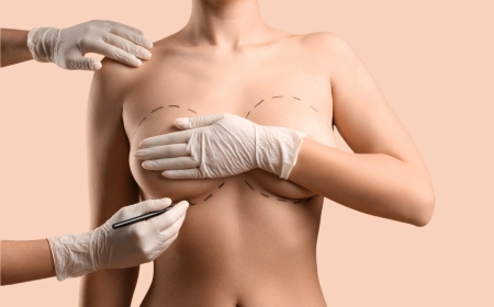 Best Breast Augmentation Surgeon in Dubai: Cost and Benefits