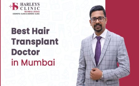 How to Choose the Best Hair Transplant Doctor?