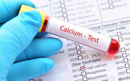 Calcium Test Price: What You Need to Know Before Booking