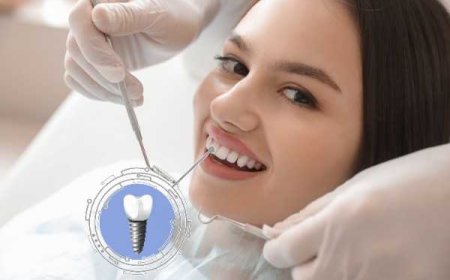 Do Dental Implants Need Special Cleaning Tools?