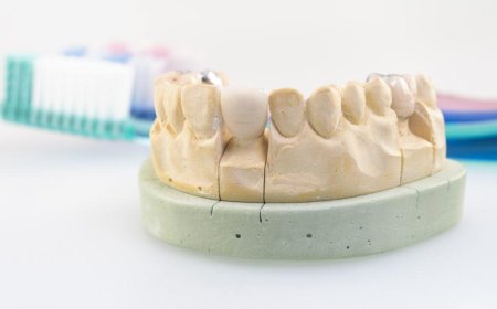 Temporary Crown Left on Too Long