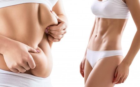 Lipo Surgery Guidance by Best Liposuction Surgeons in Dubai