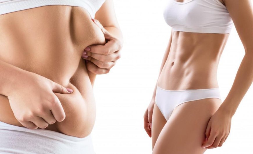 Lipo Surgery Guidance by Best Liposuction Surgeons in Dubai