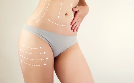 From Head to Toe Liposuction for Complete Renewal in Dubai