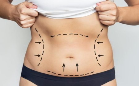 Your Roadmap to Full Body Liposuction Surgery in Dubai