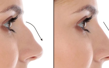Best Septoplasty Surgeons in Dubai for Functional Nasal Surgery