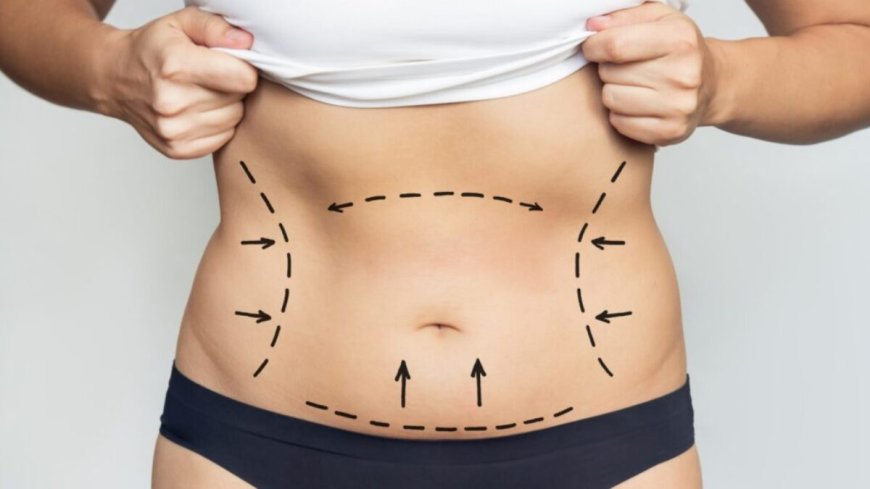 Your Roadmap to Full Body Liposuction Surgery in Dubai